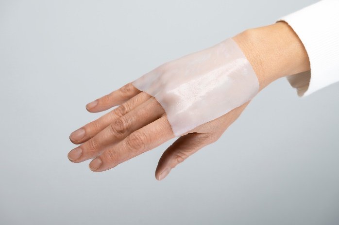 13. Celulosa (Epicite) para el tratamiento de zonas donantes y quemaduras: Nuestras experiencias iniciales