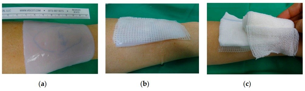16. El impacto de un apósito para heridas a base de nanocelulosa en el manejo de lesiones térmicas en niños: resultados de una evaluación retrospectiva