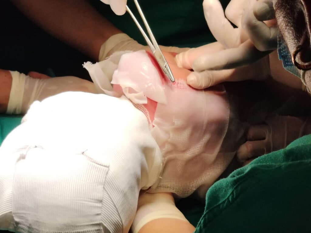 7. Epicite Hydro en el tratamiento de lesiones térmicas en niños: ¿Un nuevo estándar de atención?